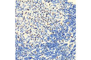 Immunohistochemistry of paraffin-embedded rat spleen using HD antibody (ABIN7267708) at dilution of 1:100 (40x lens). (HDAC2 抗体)