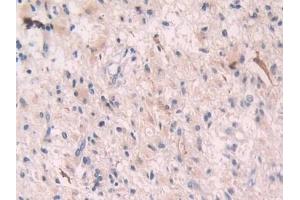 Immunohistochemistry (IHC) image for anti-2',5'-Oligoadenylate Synthetase 1, 40/46kDa (OAS1) (AA 74-165) antibody (ABIN7435079)