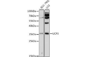 Western blot analysis of extracts of various cell lines, using UCP3 antibody (ABIN3022085, ABIN3022086, ABIN3022087, ABIN1513663 and ABIN6218600) at 1:500 dilution. (UCP3 抗体  (AA 1-110))