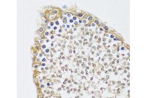 Immunohistochemistry of paraffin-embedded Rat testis using C12orf10 Polyclonal Antibody at dilution of 1:100 (40x lens). (C12orf10 抗体)