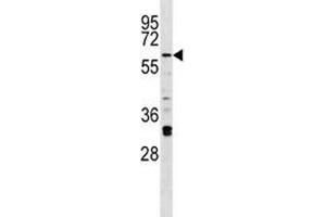 Irak2 antibody western blot analysis in A375 lysate. (IRAK2 抗体  (AA 594-622))