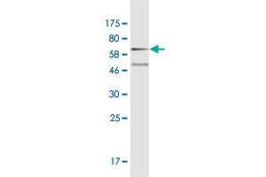 Western Blot detection against CHD11-His tag (61.