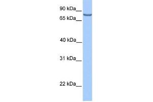 LCA5 antibody used at 1 ug/ml to detect target protein. (LCA5 抗体  (N-Term))