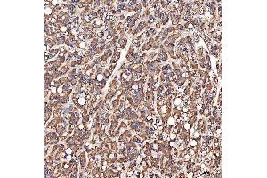 IHC analysis of SCO1 using anti-SCO1 antibody (ABIN7600609).
