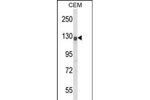 Western blot analysis of KCNH2 Antibody (Center) (ABIN652759 and ABIN2842499) in CEM cell line lysates (35 μg/lane).