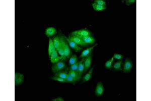 Immunofluorescence (IF) image for anti-Cystatin B (Stefin B) (CSTB) (AA 1-98) antibody (ABIN7148987)