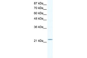 WB Suggested Anti-RGS10 Antibody   Titration: 1. (RGS10 抗体  (Middle Region))