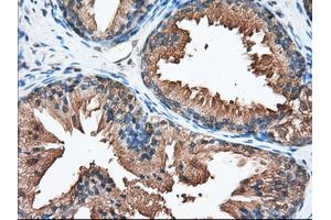 Immunohistochemical staining of paraffin-embedded Human liver tissue using anti-PANK2 mouse monoclonal antibody. (PANK2 抗体)