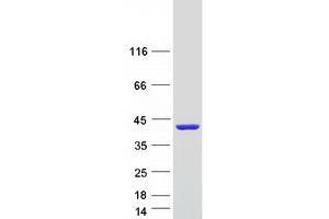 Western Blotting (WB) image for Calcium Binding Protein 39-Like (CAB39L) (Transcript Variant 2) protein (Myc-DYKDDDDK Tag) (ABIN2712999)