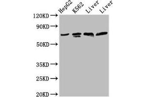 Western Blot Positive WB detected in: HepG2 whole cell lysate, K562 whole cell lysate, Rat liver tissue, Mouse liver tissue All lanes: PANX2 antibody at 4. (Pannexin 2 抗体  (AA 370-470))