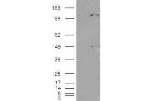 Western Blotting (WB) image for anti-Pyruvate Carboxylase (PC) (Internal Region) antibody (ABIN2466170) (PC 抗体  (Internal Region))