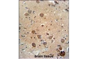 C antibody (Center) (ABIN654951 and ABIN2844592) immunohistochemistry analysis in formalin fixed and paraffin embedded human brain tissue followed by peroxidase conjugation of the secondary antibody and DAB staining. (C6ORF62 抗体  (AA 118-147))