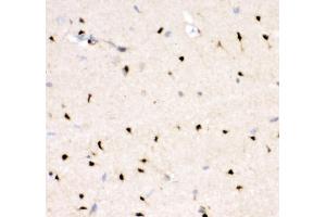 anti-V-Crk Sarcoma Virus CT10 Oncogene Homolog (Avian) (CRK) (AA 2-246) antibody