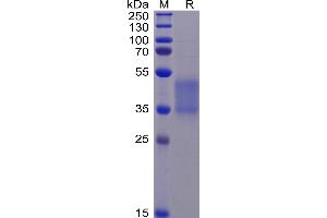SDS-PAGE (SDS) image for Fc Fragment of IgG, Low Affinity IIIa, Receptor (CD16a) (FCGR3A) (AA 17-206) protein (His tag) (ABIN6961127)