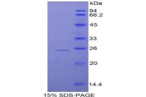 SDS-PAGE analysis of Rat TNIP2 Protein. (TNIP2 蛋白)
