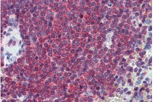 ABIN571033 (2. (CA1 抗体  (Internal Region))