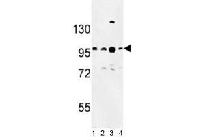 Western blot analysis of BCL11A antibody and 1) Jurkat, 2) Ramos, 3) 293 and 4)NCI-H460 lysate. (BCL11A 抗体  (AA 806-835))