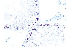 Immunohistochemistry (IHC) image for anti-Histone Acetyltransferase 1 (HAT1) antibody (ABIN7267702)