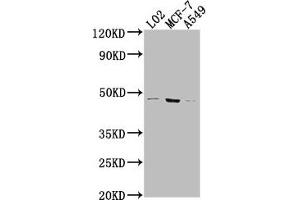 Western Blot Positive WB detected in: LO2 whole cell lysate, MCF-7 whole cell lysate, A549 whole cell lysate All lanes: USP17L6P antibody at 1:2000 Secondary Goat polyclonal to rabbit IgG at 1/50000 dilution Predicted band size: 45 kDa Observed band size: 45 kDa (USP17L6P 抗体  (C-Term))