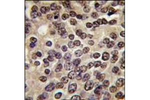Image no. 2 for anti-Protein Kinase N3 (PKN3) (C-Term) antibody (ABIN360331) (PKN3 抗体  (C-Term))