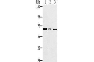 Western Blotting (WB) image for anti-Insulin-Like Growth Factor 2 mRNA Binding Protein 3 (IGF2BP3) antibody (ABIN2428265) (IGF2BP3 抗体)