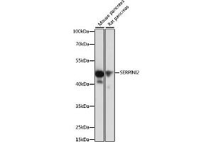 Western blot analysis of extracts of various cell lines, using SERPINI2 antibody (ABIN6131321, ABIN6147617, ABIN6147618 and ABIN6215429) at 1:1000 dilution. (SERPINI2 抗体  (AA 56-405))