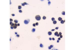 IHC analysis of Thioredoxin TRX using anti-Thioredoxin TRX antibody (ABIN6719381). (TXN 抗体  (AA 2-105))