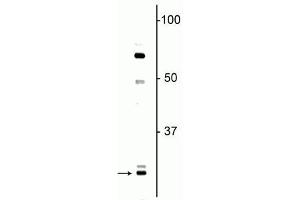 Western blot of neonatal rat brain lysate showing specific immunolabeling of the ~ 27 kDa Olig1 protein. (OLIG1 抗体)