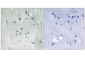 Immunohistochemistry analysis of paraffin-embedded human brain tissue using SRF (Phospho-Ser77) antibody. (SRF 抗体  (pSer77))