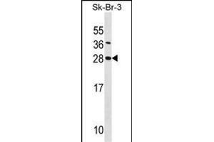 SDC4 Antibody (Center) (ABIN1538722 and ABIN2848544) western blot analysis in SK-BR-3 cell line lysates (35 μg/lane). (SDC4 抗体  (AA 98-127))