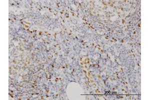 Immunoperoxidase of monoclonal antibody to EBF3 on formalin-fixed paraffin-embedded human lymph node.