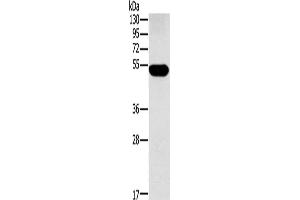 Gel: 8 % SDS-PAGE, Lysate: 60 μg, Lane: Human placenta tissue, Primary antibody: ABIN7129551(FUCA1 Antibody) at dilution 1/500, Secondary antibody: Goat anti rabbit IgG at 1/8000 dilution, Exposure time: 2 minutes (FUCA1 抗体)