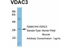 Host: Rabbit Target Name: VDAC3 Sample Type: Human Fetal Muscle Antibody Dilution: 1. (VDAC3 抗体  (N-Term))