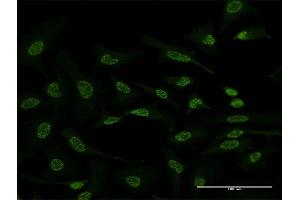 Immunofluorescence of monoclonal antibody to ATF2 on HeLa cell. (ATF2 抗体  (AA 91-190))