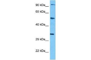 Host:  Mouse  Target Name:  TCF7L2  Sample Tissue:  Mouse Kidney  Antibody Dilution:  1ug/ml (TCF7L2 抗体  (N-Term))