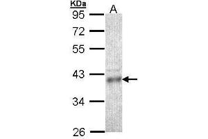 WB Image Sample (30 ug of whole cell lysate) A: HCT116 10% SDS PAGE antibody diluted at 1:1000 (CPOX 抗体)