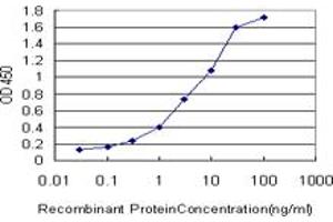 Detection limit for recombinant GST tagged IRAK1 is approximately 0.