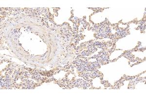 Detection of IL9 in Human Lung Tissue using Polyclonal Antibody to Interleukin 9 (IL9) (IL-9 抗体  (AA 19-144))