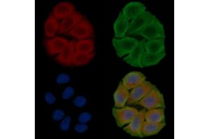 ABIN6260819 and ABIN6276752 staining Hela cells(30 min of UV treatment) by IF/ICC.