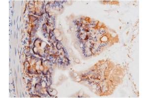 Immunohistochemistry (IHC) image for anti-Mast/stem Cell Growth Factor Receptor (KIT) (pTyr703) antibody (ABIN6255994)