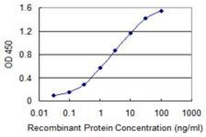 Detection limit for recombinant GST tagged SECISBP2 is 0. (SECISBP2 抗体  (AA 106-205))