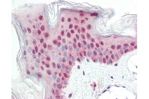 Anti-ATG14 antibody IHC staining of human skin. (ATG14 抗体  (Internal Region))