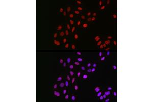 Immunofluorescence analysis of U2OS cells using GPS1 Rabbit pAb (ABIN6127934, ABIN6141361, ABIN6141362 and ABIN6222653) at dilution of 1:100 (40x lens).