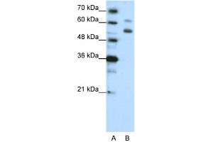 WB Suggested Anti-WDR4 Antibody Titration:  1. (WDR4 抗体  (C-Term))