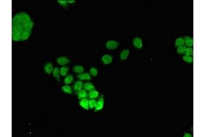 Immunofluorescent analysis of PC-3 cells using ABIN7153101 at dilution of 1:100 and Alexa Fluor 488-congugated AffiniPure Goat Anti-Rabbit IgG(H+L) (FOXQ1 抗体  (AA 10-123))