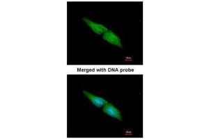 ICC/IF Image Immunofluorescence analysis of paraformaldehyde-fixed HeLa, using MAPK4, antibody at 1:200 dilution. (MAPK4 抗体)