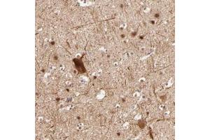 Immunohistochemical staining of human cerebral cortex with CLOCK polyclonal antibody  shows moderate nuclear positivity in neuronal cells. (CLOCK 抗体)