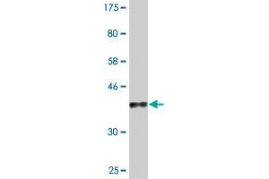 Western Blot detection against Immunogen (37. (MYBL1 抗体  (AA 625-734))