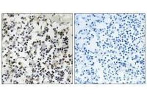 Immunohistochemistry analysis of paraffin-embedded human lymph node tissue using CLIC4 antibody. (CLIC4 抗体  (N-Term))