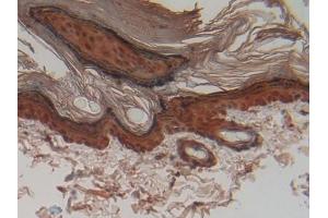 DAB staining on IHC-P; Samples: Rat Skin Tissue (CSTA 抗体  (AA 1-103))